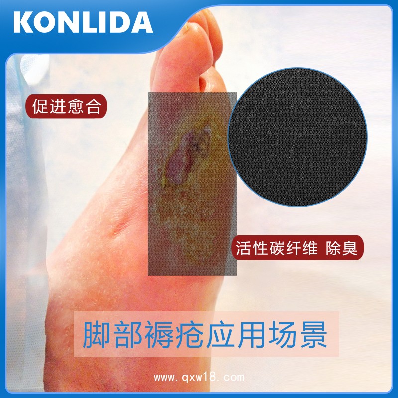 普外科活性碳敷料 褥瘡潰瘍傷口敷料oem