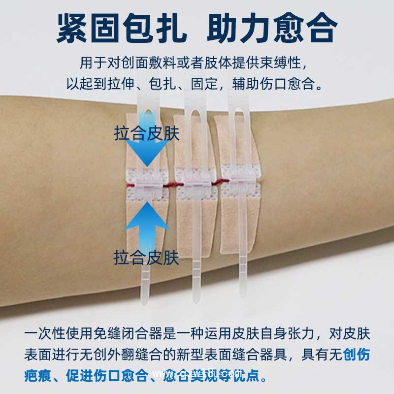 醫用疤痕減張器 皮膚免縫合oem