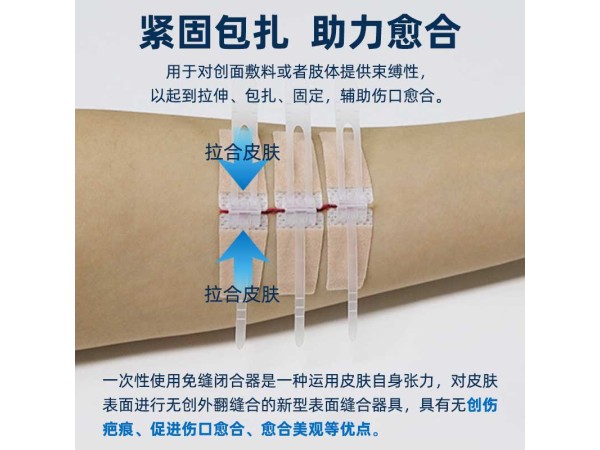 醫用免縫閉合器 減張貼 可代工