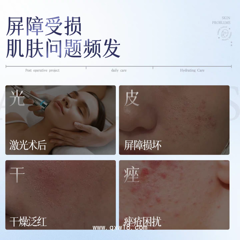 透明質酸鈉敷料 現貨批發二類械字號院線非面膜醫用冷敷貼廠家
