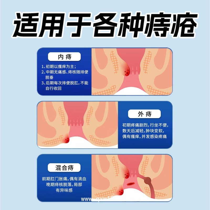 痔瘡凝膠 批發(fā)草本萃取肛門墜脹瘙癢槐實(shí)膏廠家定制內(nèi)外通用痔瘡膏