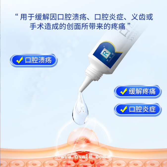 口腔潰瘍凝膠緩解口腔黏膜嘴起泡炎癥義齒術后腫痛護理凝膠