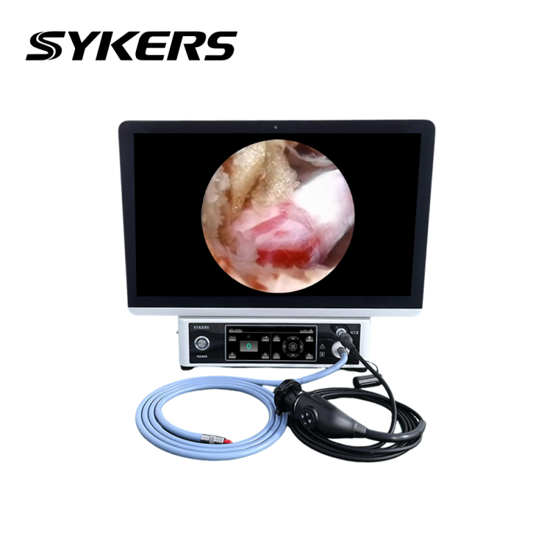 4K portable endoscope camera system for general surgery