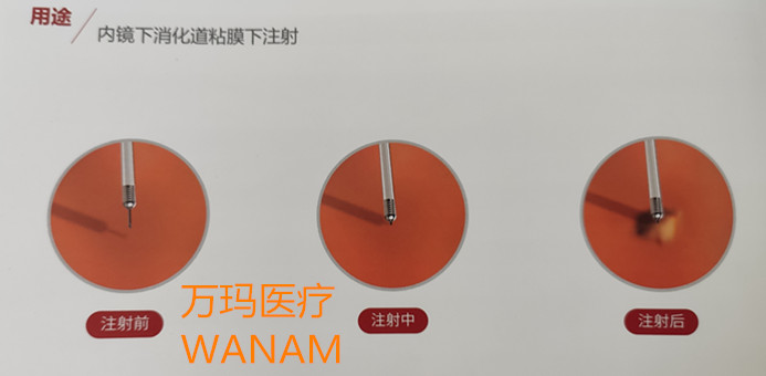 一次性內鏡用注射針2_副本.jpg