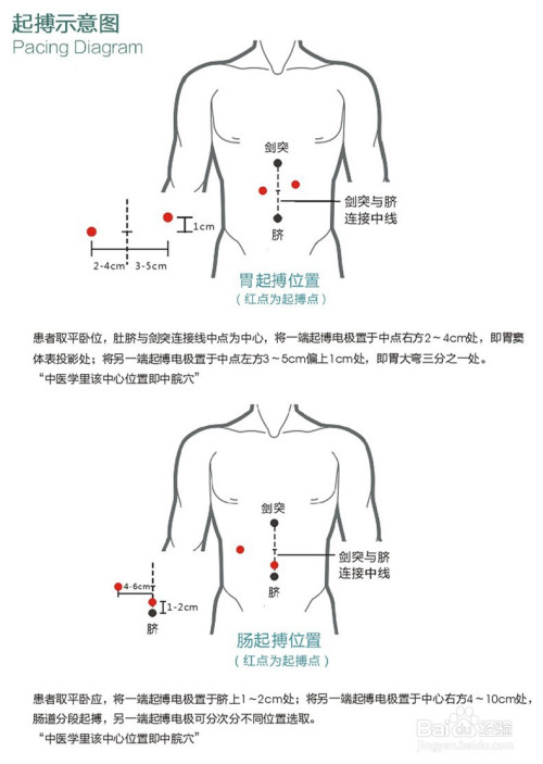 05a320a23a42a07ac9f75081673834bb18efc179.jpg