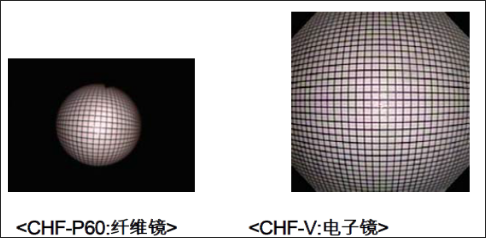CHF TYPE V.png
