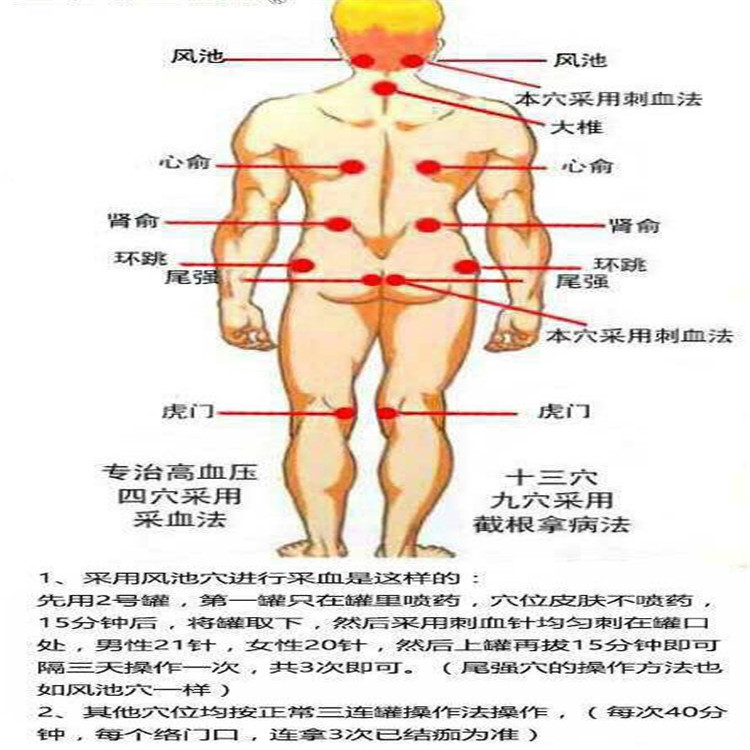 穴位3.jpg
