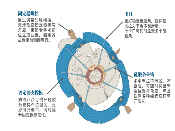牽開固定器彩頁 定稿_01.png