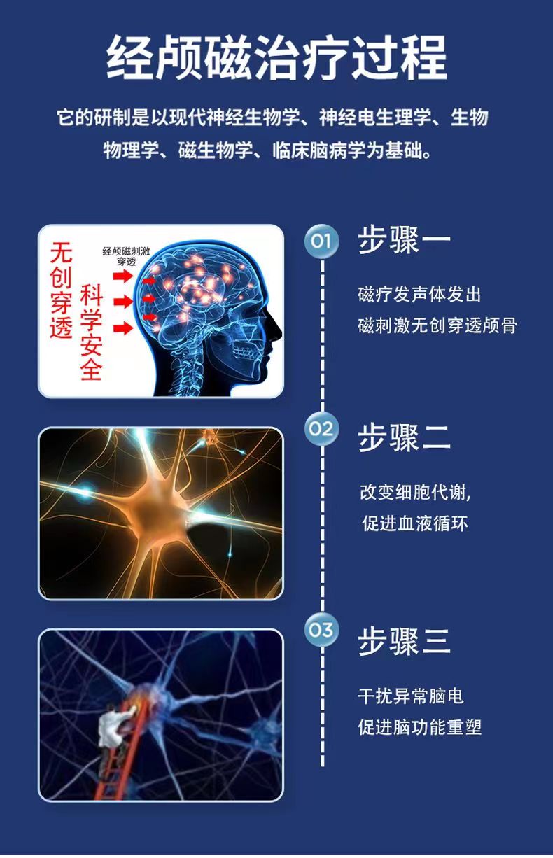 經(jīng)顱磁電療儀.jpg