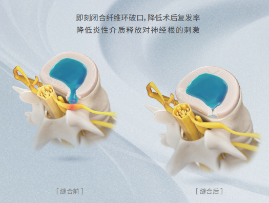 26d7e705ee2631667183aacf613de57.png