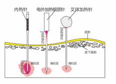 d06c56564463afea773ee9382f80b71.png