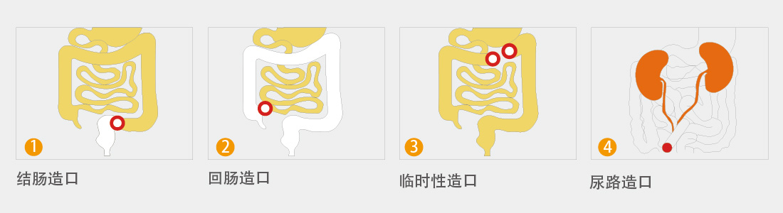 造口袋2.jpg
